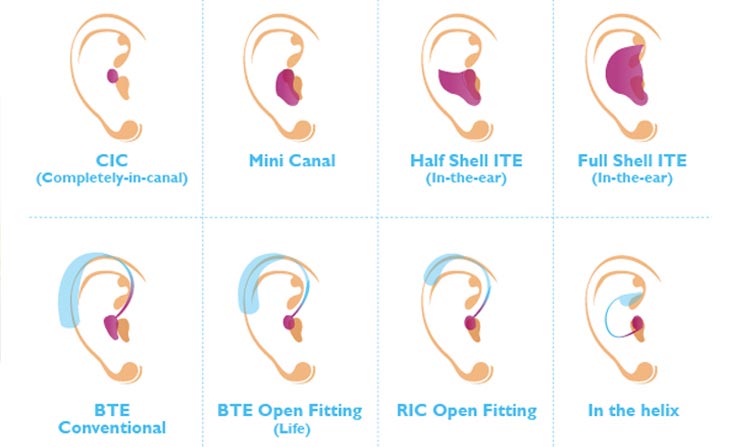 Hearing Aids Comparison and Choosion Guide